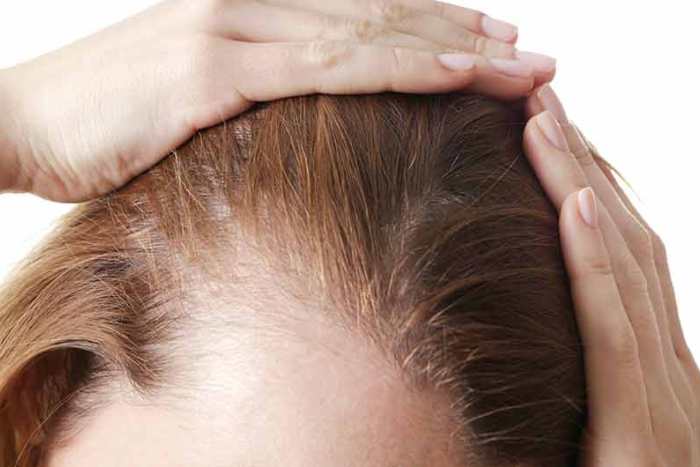 Jak pielęgnować cienkie włosy? Sposoby na wzmocnienie włosów