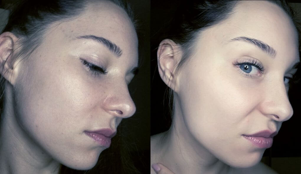 Zabieg pigmentacji BB Glow – makijaż permanentny twarzy