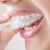 Wybielanie zębów – najlepsze sposoby